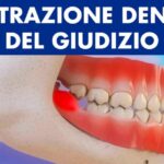 Dorsalgia: sintomi e trattamento