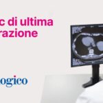 Rimedi della Nonna per Combattere l’Aria nello Stomaco
