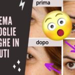 Macchia Rossa Sotto il Seno: Cause e Rimedi