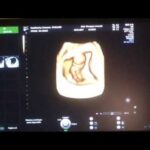 Puiatti Dermatologo: Eccellenza nella Cura della Pelle