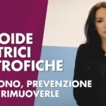 Tendine d’Achille: scopri i tempi di recupero per una lesione parziale