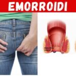 Brucia Le Verruche: Metodi Efficaci per Eliminare Le Verruche