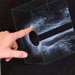 Dolori Mestruali Senza Ciclo: Comprendere la Premenopausa