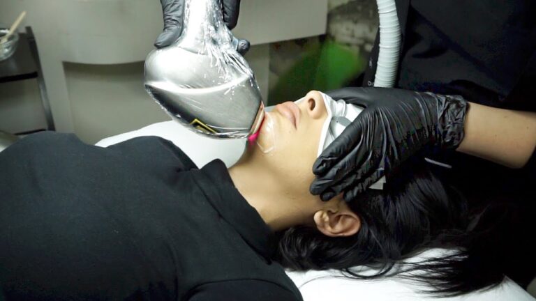 Trasformazione del viso con il trattamento laser: prima e dopo
