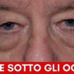 Lassativi Forti: Efficacia e Rischi da Conoscere