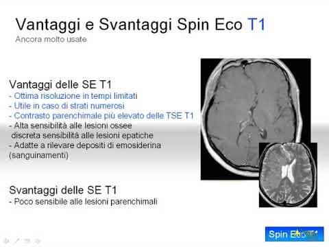 La verità sull’ultimo fad dei grassi: scopri se funziona!
