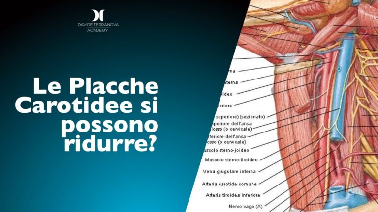 Ecodoppler carotideo: scopri i valori normali per una diagnosi accurata!