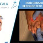 Come affrontare il dolore alle protesi al ginocchio