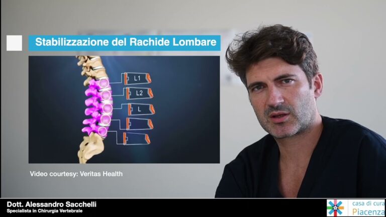 Il segreto della stabilizzazione vertebrale: scopri come il punteggio invalidità può fare la differenza!