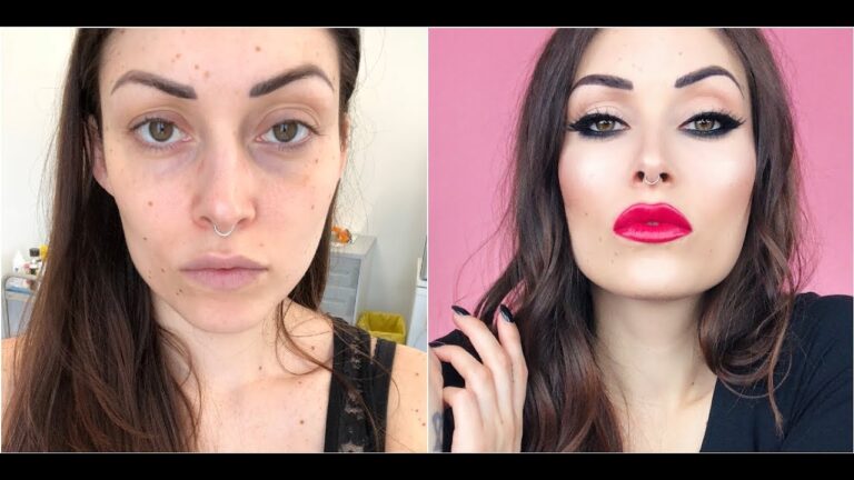 Filler occhiaie: i pro e i contro dell’ultima tendenza!
