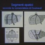 Cerotti per trocanterite: il rimedio salva