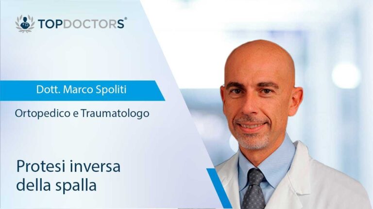 Protesi inversa spalla: evita questi movimenti per un recupero più efficace!