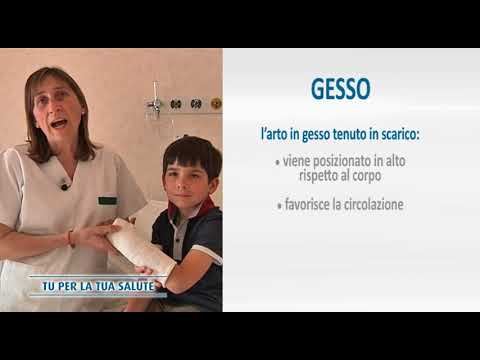 Addio al cattivo odore del gesso: scopri i migliori rimedi!