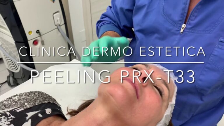 PRX T33: Prima e Dopo