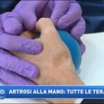 Brucia Le Verruche: Metodi Efficaci per Eliminare Le Verruche