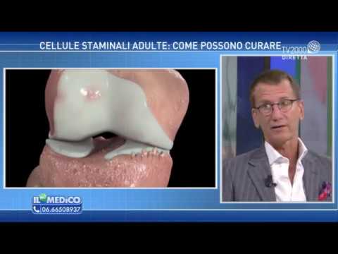 Trapianto cellule mesenchimali al ginocchio: opinioni a confronto!