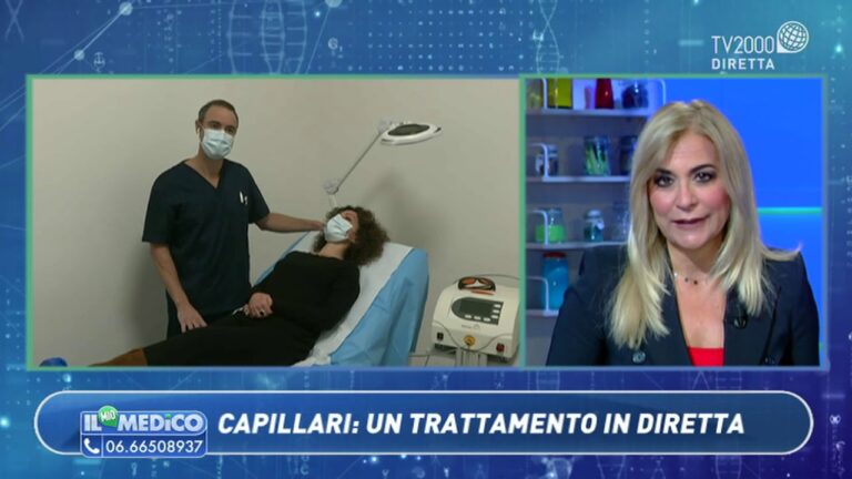 Risultati del Trattamento Laser per Capillari sul Viso: Prima e Dopo