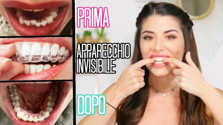 Il segreto delle mascherine per denti: l’efficacia delle soluzioni farmaceutiche!