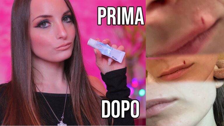 Xioglican Crema: Opinioni Shock! Scopri se Funziona Davvero!
