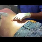Quando Consultare il Fisiatra: Guida Pratica