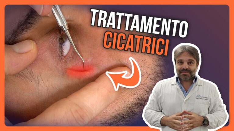 Contratubex: Trasformazione strabiliante – Prima e dopo in 70 giorni