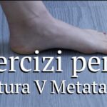 Trattamenti alternativi per la frattura del femore: evitare l’operazione