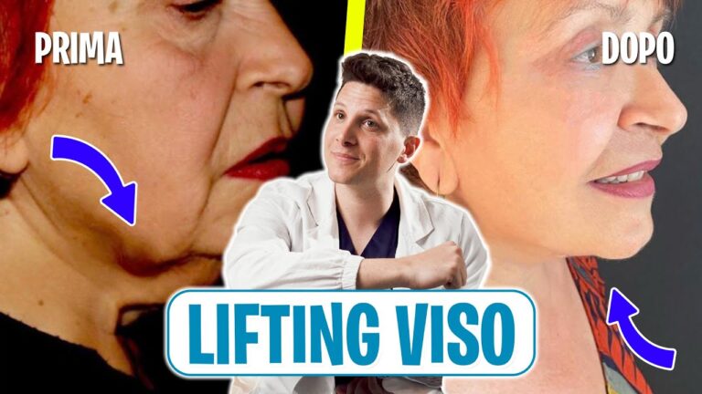 Costo del lifting al viso: tutto quello che devi sapere