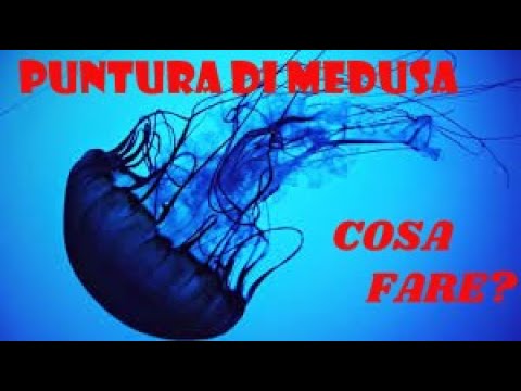 Cloruro di alluminio: il segreto contro le punture delle meduse