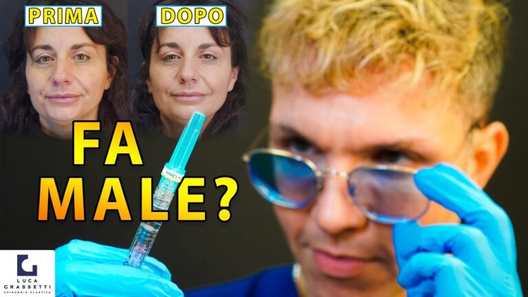 Botox: miracolo contro le zampe di gallina – Scopri i risultati prima e dopo!