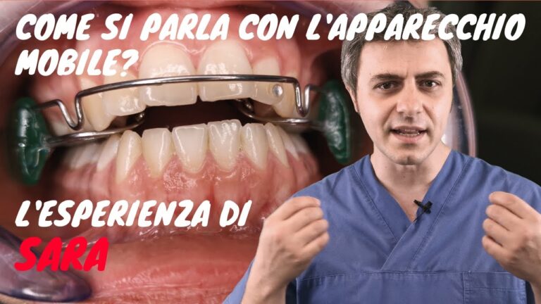 Vantaggi dell’Apparecchio Mobile Notturno per la Correzione Dentale