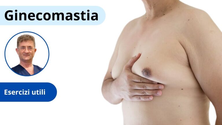 Ginecomastia: Come prevenirla e gestirla nella palestra