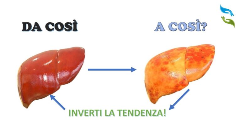 Le cause del gonfiore degli occhi correlato al fegato: analisi ottimizzata