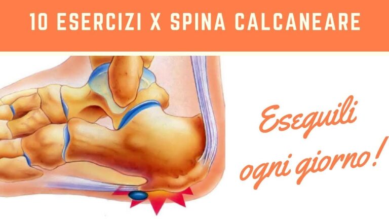Trattamento efficace per le spine calcaree: Plantari specializzati