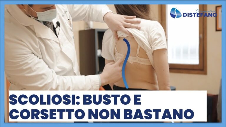 Busto Innovativo per la Scoliosi: Soluzioni Efficaci e Comfort Ottimale