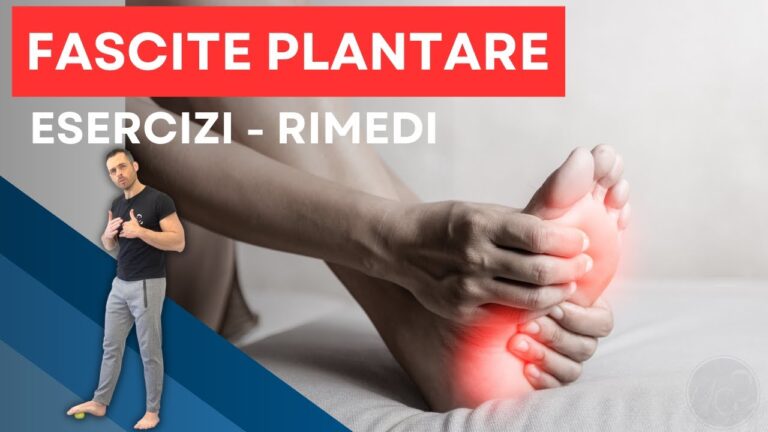 Curare la Fascite Plantare: Strategie Efficaci