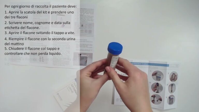 Esame Citologico Urine: Analisi di Tre Campioni