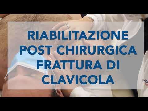 Frattura della clavicola: cosa fare dopo un mese