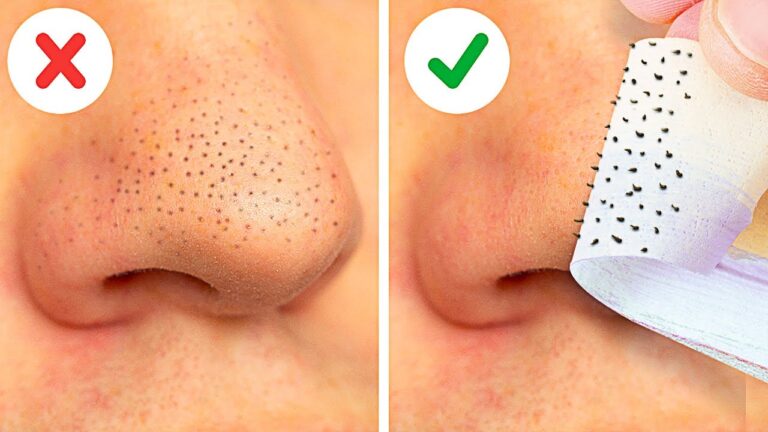 Maschera Punti Neri: Il Segreto per una Pelle Perfetta