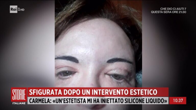 La chirurgia conclusiva: l’intervento finale per il successo