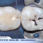 Durata della pulizia dei denti: tutto quello che devi sapere