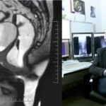 Denti sani e verruche miracolosamente scomparse: il segreto del dentifricio!