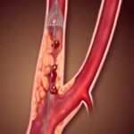 Recensioni sulla Clinica Pederzoli: Esperienze e Opinioni
