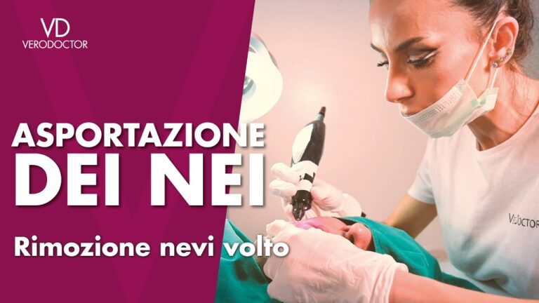 Nei Verrucosi: Guida Completa