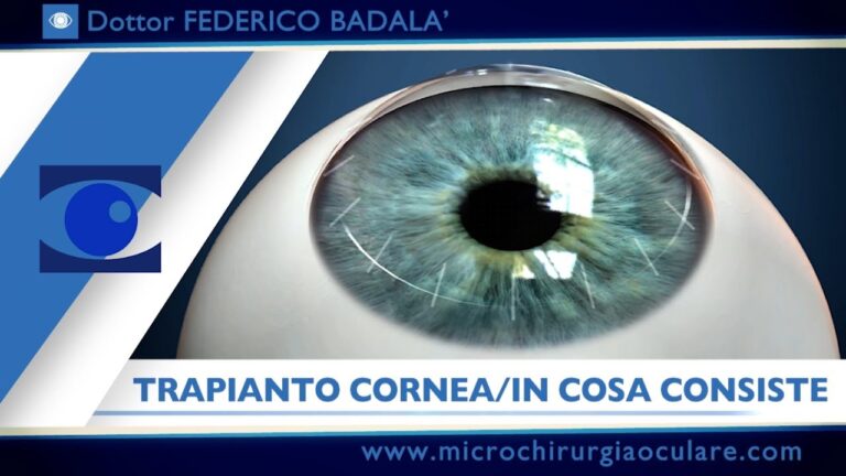 La verità dietro la pseudofachia occhio