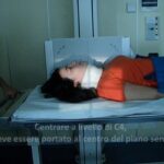 Ricrescita miracolosa: i capelli caduti per carenza di ferro tornano pi&ugrave; forti