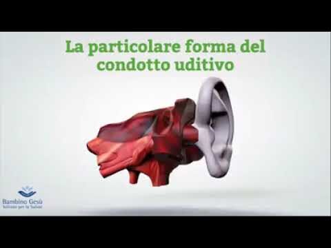 La rimozione del tappo di cerume: la soluzione ottimizzata dalla farmacia