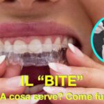 Trigemino infiammato: cause, sintomi e cure per i dolori ai denti