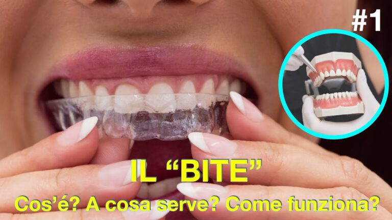 Bite Dentale: Soluzione per il Rilassamento Muscolare