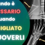 Melanzana fritta: calorie e informazioni nutrizionali