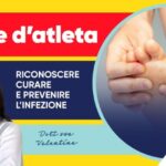 Ruolo dell’anticorpo anti-citrullina nella patologia